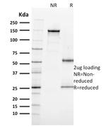 Ki-67 Antibody in SDS-PAGE (SDS-PAGE)
