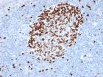 Ki-67 Antibody in Immunohistochemistry (Paraffin) (IHC (P))