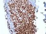 Ki-67 Antibody in Immunohistochemistry (Paraffin) (IHC (P))