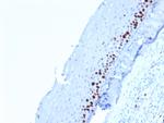 Ki-67 Antibody in Immunohistochemistry (Paraffin) (IHC (P))