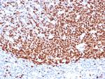 Ki-67 (Proliferating Cell Marker) Antibody in Immunohistochemistry (Paraffin) (IHC (P))