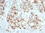 Ki-67 Antibody in Immunohistochemistry (Paraffin) (IHC (P))