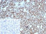 Ki-67 (Proliferating Cell Marker) Antibody in Immunohistochemistry (Paraffin) (IHC (P))