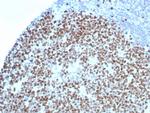 Ki-67 (Proliferating Cell Marker) Antibody in Immunohistochemistry (Paraffin) (IHC (P))