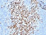 Ki-67 (Proliferating Cell Marker) Antibody in Immunohistochemistry (Paraffin) (IHC (P))