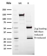 Ki-67 (Proliferating Cell Marker) Antibody in SDS-PAGE (SDS-PAGE)
