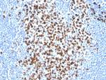 Ki-67 Antibody in Immunohistochemistry (Paraffin) (IHC (P))