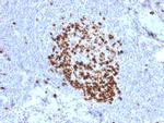 Ki-67 Antibody in Immunohistochemistry (Paraffin) (IHC (P))