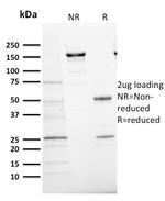 Ki-67 Antibody in SDS-PAGE (SDS-PAGE)