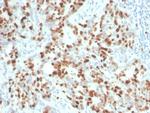 Ki-67 Recombinant Rabbit Monoclonal Antibody (MKI67, 4945R)