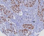 Ki-67 (Proliferating Cell Marker) Antibody in Immunohistochemistry (Paraffin) (IHC (P))