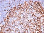 Ki-67 (Proliferating Cell Marker) Antibody in Immunohistochemistry (Paraffin) (IHC (P))