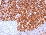 Ki-67 (Proliferating Cell Marker) Antibody in Immunohistochemistry (Paraffin) (IHC (P))