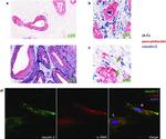 Claudin 2 Antibody in Immunohistochemistry (IHC)