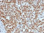 MLH1 (MutL Homolog 1) (Center)/HNPCC Antibody in Immunohistochemistry (Paraffin) (IHC (P))