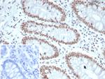 MLH1 (MutL Homolog 1) (Center)/HNPCC Antibody in Immunohistochemistry (Paraffin) (IHC (P))