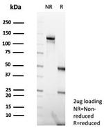 MLH1 (MutL Homolog 1) (Center)/HNPCC Antibody in SDS-PAGE (SDS-PAGE)
