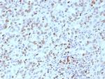 MLH1 (MutL Homolog 1) (Center)/HNPCC Recombinant Mouse Monoclonal Antibody (rMLH1/8630)