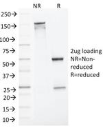 MLH1 (MutL Homolog 1) Monoclonal Antibody (MLH1/1324)