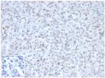 MLH1 (MutL Homolog 1)/HNPCC Monoclonal Antibody (MLH1/6467)