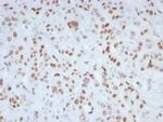 MLH1 (MutL Homolog 1)/HNPCC Recombinant Rabbit Monoclonal Antibody (MLH1/8855R)