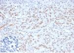 MLH1 (MutL Homolog 1)/HNPCC Recombinant Rabbit Monoclonal Antibody (MLH1/6284R)
