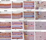 PRDX3 Antibody in Immunohistochemistry (IHC)