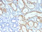 NR3C2/Mineralocorticoid Receptor Monoclonal Antibody (NR3C2/4900)
