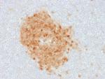 CD10 (Membrane Metalloendopeptidase) Monoclonal Antibody (MME, 1893)