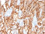 CD10 (Membrane Metalloendopeptidase) Monoclonal Antibody (MME/2579)