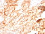 CD10 (Membrane Metalloendopeptidase) Antibody in Immunohistochemistry (Paraffin) (IHC (P))