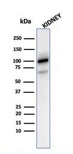 CD10 (Membrane Metalloendopeptidase) Antibody in Western Blot (WB)