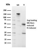 CD10 (Membrane Metalloendopeptidase) Antibody in SDS-PAGE (SDS-PAGE)