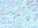 CD10 (Membrane Metalloendopeptidase) Antibody in Immunohistochemistry (Paraffin) (IHC (P))