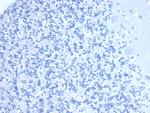 CD10 (Membrane Metalloendopeptidase) Antibody in Immunohistochemistry (Paraffin) (IHC (P))