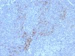 CD10 (Membrane Metalloendopeptidase) Recombinant Mouse Monoclonal Antibody (rMME/8584)