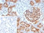 CD10 (Membrane Metalloendopeptidase) Recombinant Mouse Monoclonal Antibody (rMME/9377)