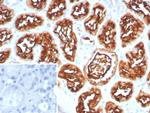 CD10 (Membrane Metalloendopeptidase) Recombinant Rabbit Monoclonal Antibody (MME/8281R)