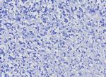CD10 (Membrane Metalloendopeptidase) Recombinant Rabbit Monoclonal Antibody (MME/8376R)
