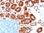 CD10 (Membrane Metalloendopeptidase) Recombinant Rabbit Monoclonal Antibody (MME/9617R)