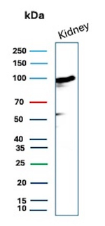 CD10 (Membrane Metalloendopeptidase) Antibody in Western Blot (WB)