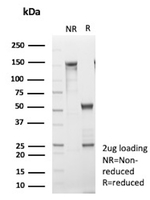CD10 (Membrane Metalloendopeptidase) Antibody in SDS-PAGE (SDS-PAGE)