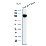 CD10 (Membrane Metalloendopeptidase) Antibody in Western Blot (WB)