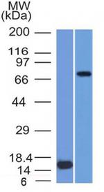 MMP2/Collagenase Type IV A (Tumor Metastasis Marker) Monoclonal Antibody (MMP2/1501)