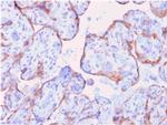 MMP3 Recombinant Mouse Monoclonal Antibody (rMMP3, 1730)
