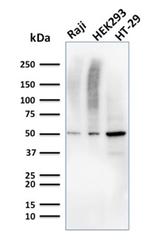 MMP3 Monoclonal Antibody (MMP3, 2655)