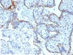 MMP3 (Marker of Metastasis and Rheumatoid Arthritis) Monoclonal Antibody (MMP3/2806)
