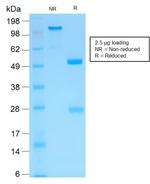 MMP3 (Marker of Metastasis and Rheumatoid Arthritis) Recombinant Rabbit Monoclonal Antibody (MMP3/1994R)