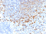 MMP9 Matrix Metalloproteinase 9 (Papillary Thyroid Carcinoma Marker) Recombinant Mouse Monoclonal Antibody (r15W2)