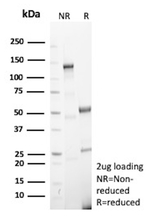 MMP9 Matrix Metalloproteinase 9 (Papillary Thyroid Carcinoma Marker) Antibody in SDS-PAGE (SDS-PAGE)
